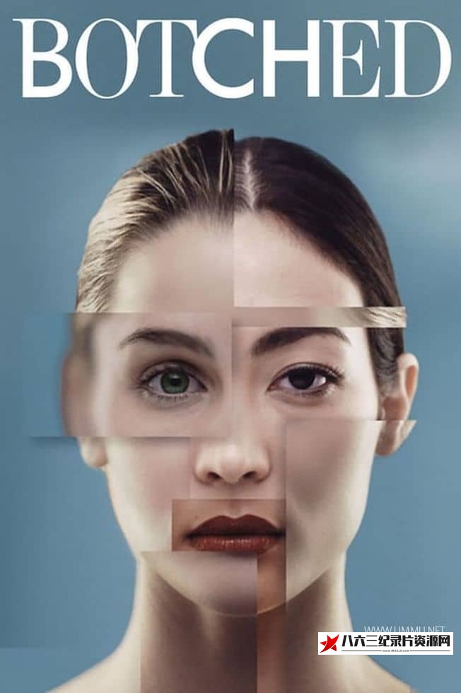 美国纪录片《拯救失败整形术 Botched》高清下载-八六三纪录片资源网