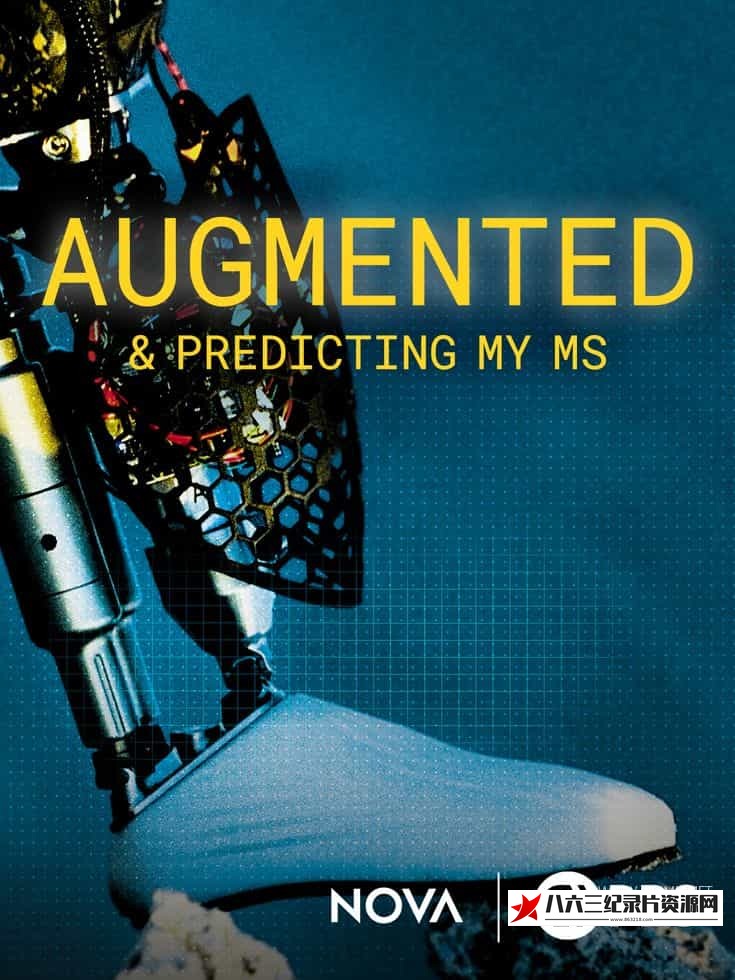 美国纪录片《我的多发性硬化症增强与预测 Augmented & Predicting My MS》高清下载-八六三纪录片资源网
