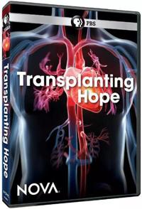 美国纪录片《移植希望 PBS Nova Transplanting HOPE》高清下载-八六三纪录片资源网