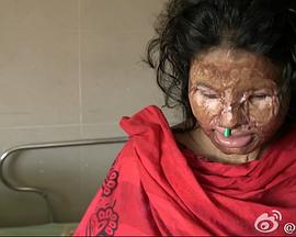 英国纪录片《无脸女孩 The Girl Who Lost Her Face》高清下载-八六三纪录片资源网